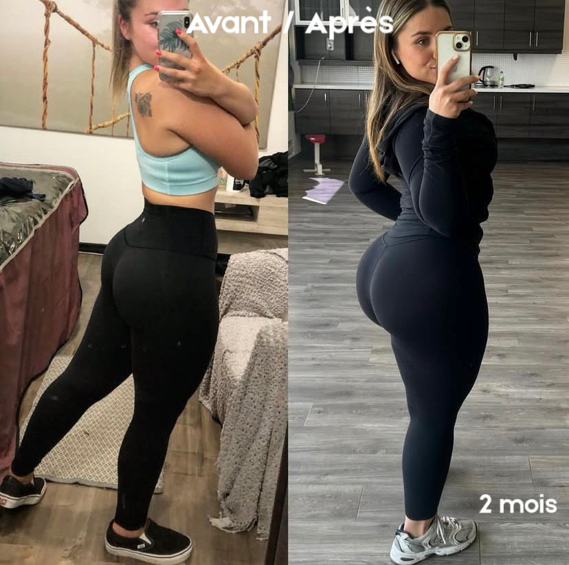 Gummies BBL - Normal. | 120 Gummies Premium / 2 Mois