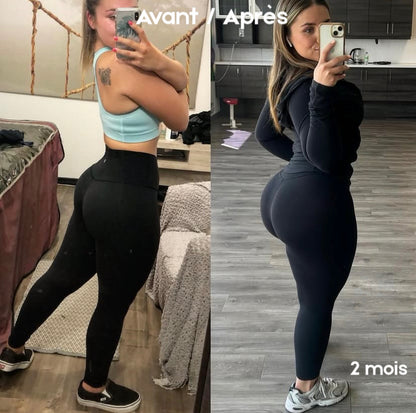 Gummies BBL - Normal. | 60 Gummies / 1 Mois