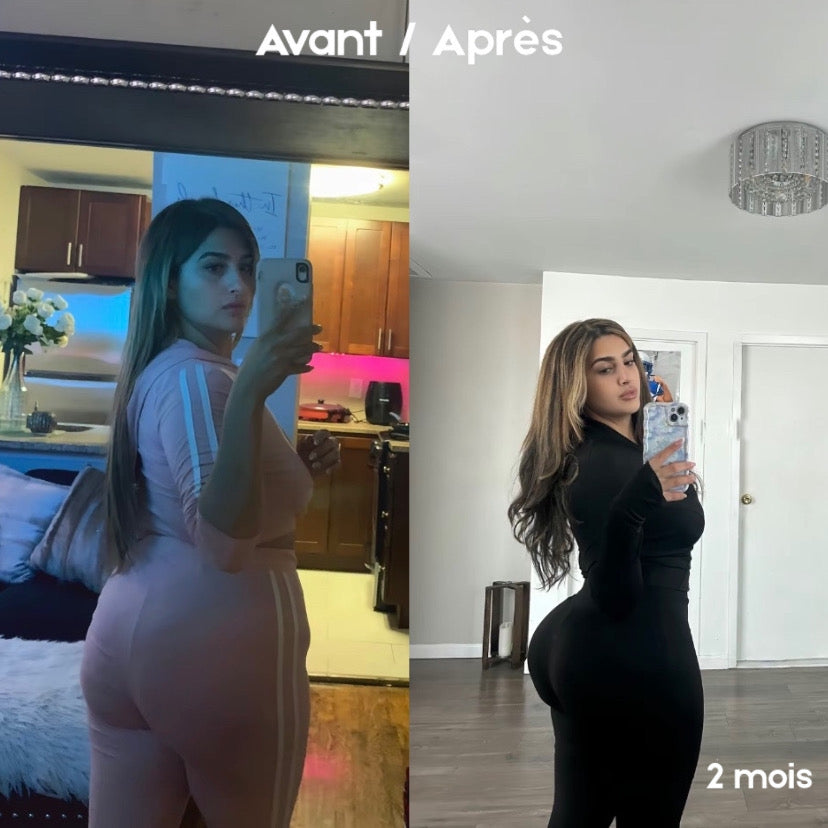 Gummies BBL - Normal. | 120 Gummies Premium / 2 Mois