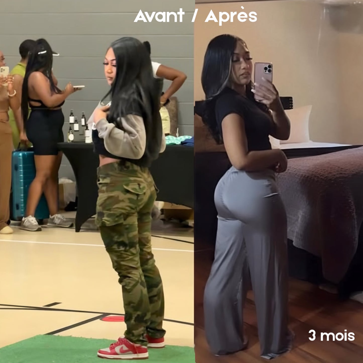 Gummies BBL - Normal. | 120 Gummies Premium / 2 Mois