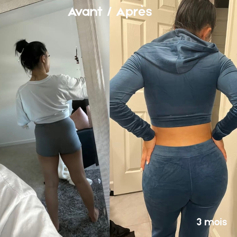 Gummies BBL - Normal. | 120 Gummies Premium / 2 Mois