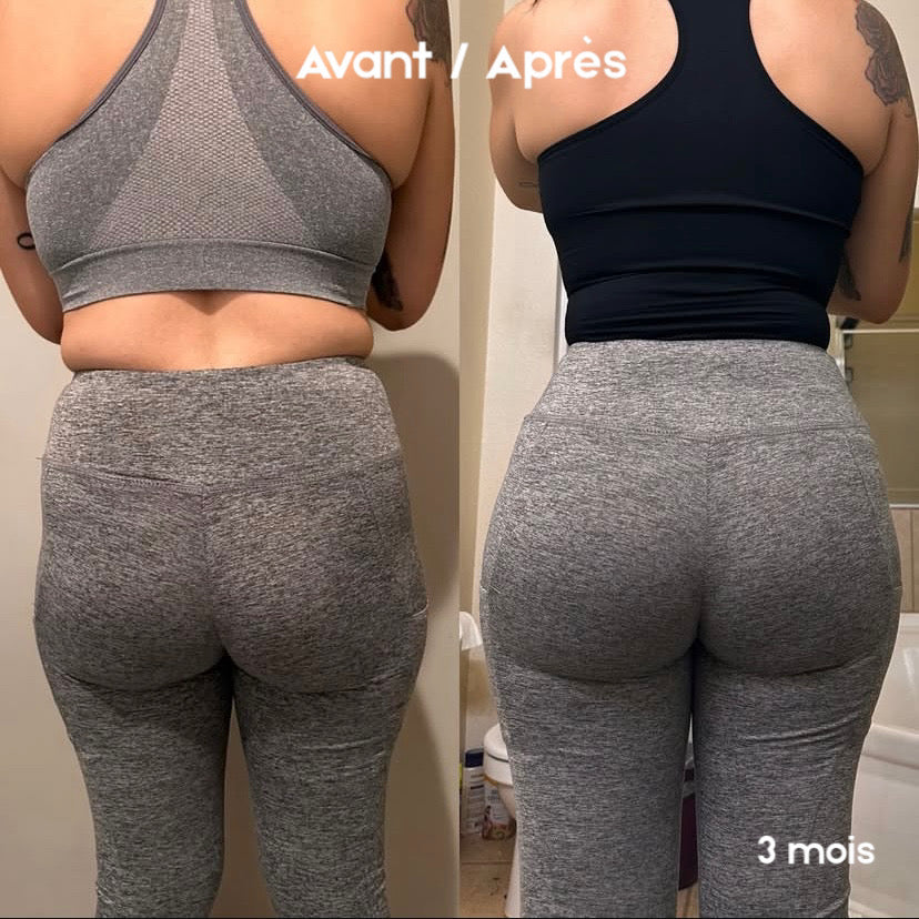 Gummies BBL - Normal. | 120 Gummies Premium / 2 Mois