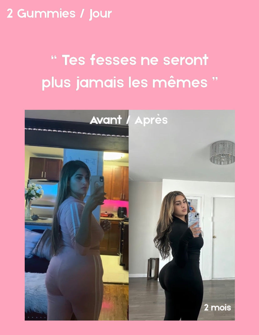 Gummies BBL - Normal. | 120 Gummies Premium / 2 Mois