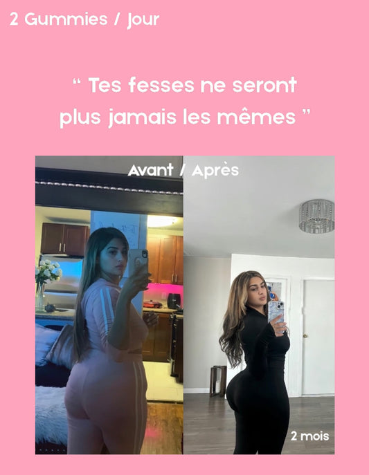 Gummies BBL - Normal. | 60 Gummies acidulés / 1 Mois